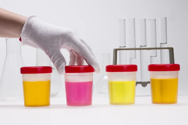 Doping test van urine op laboratorium — Stockfoto