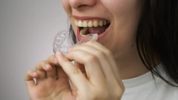 Vista frontal da mulher removendo aligner transparente invisível da mandíbula superior e demonstrar sorriso. — Vídeo de Stock