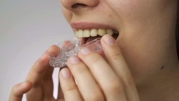 Front view of woman inserting transparent aligners on the upper jaw. — Stock Video