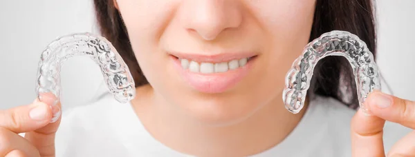 Fröhliche junge Frau mit transparenten Zahnspangen aus Plastik. Kieferorthopädischer Silikon-Aligner zum Aufhellen und Richten. — Stockfoto
