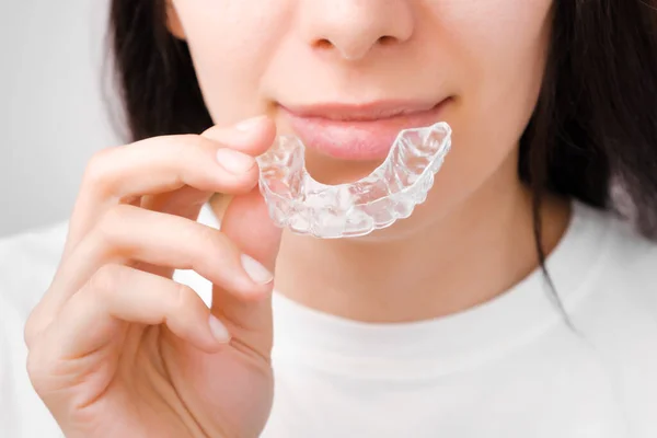 Close up de uma jovem mulher ajustando alinhadores transparentes. A tratar dos dentes. Tratamento ortodôntico para alisamento e clareamento dos dentes. — Fotografia de Stock