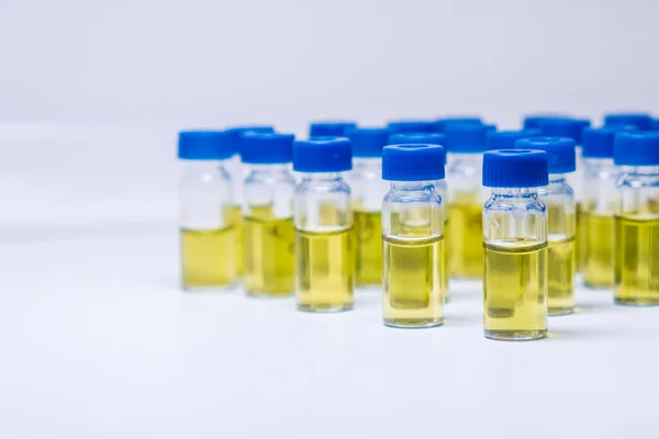Testbuizen Met Urinemonster Voor Hplc Analyse Het Laboratorium — Stockfoto