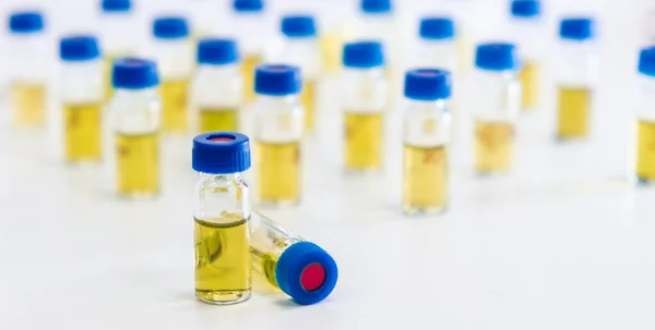 Reagenzgläser Mit Urinprobe Für Die Hplc Analyse Labor — Stockfoto
