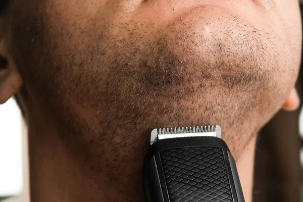 Homem Fazer Barba Curta Irritação Após Conceito Barbeação Elétrica — Fotografia de Stock