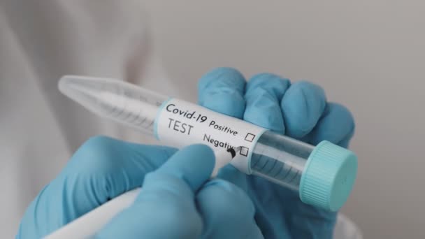Laboratoriummedewerker vult een negatief coronavirus op de reageerbuis in blauwe rubberen handschoenen — Stockvideo