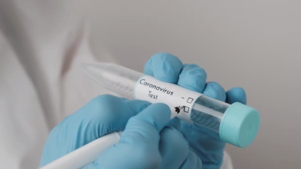 Laborangestellte füllt mit blauen Gummihandschuhen ein positives Coronavirus im Reagenzglas — Stockvideo