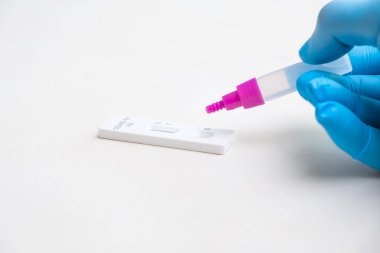 KOVID-19 antijen testine plastik eldivenli laboratuvar çalışanı tarafından reaktörü bırak.