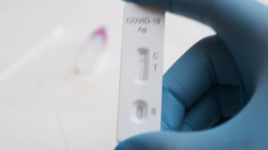 Plastik eldivenli doktor tarafından yapılan negatif hızlı antijenik Covid-19 testi..