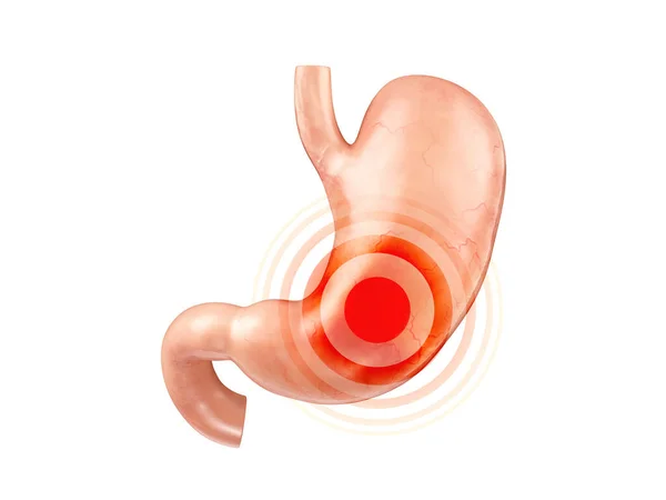 Anatomically accurate realistic 3d illustration of human internal organ - stomach — Stock Photo, Image