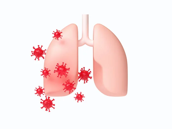 Human lungs attacked by virus —  Fotos de Stock