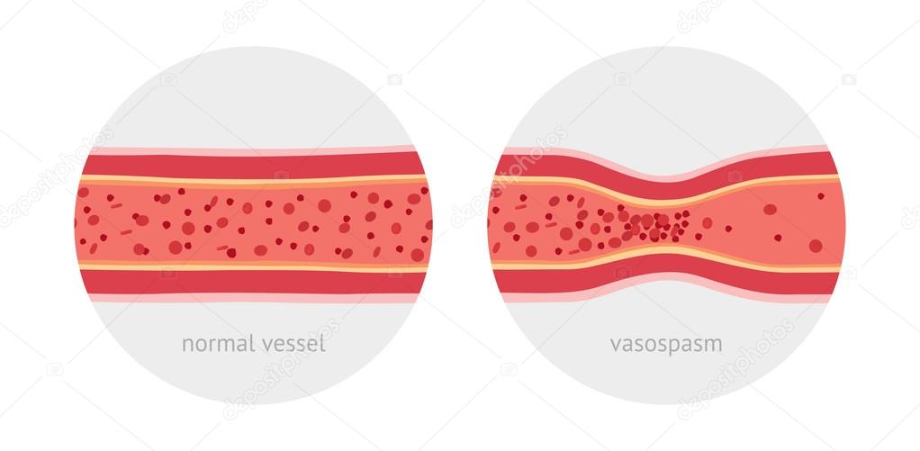 Healthy and sick human vessels