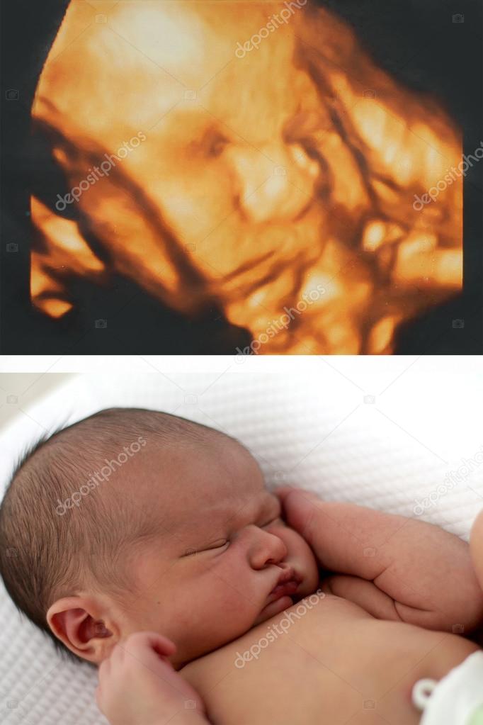 3D ultrasound of baby and newborn