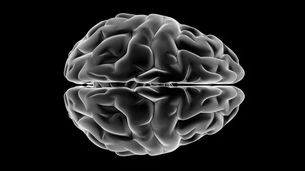 Мозг рентгена — стоковое фото