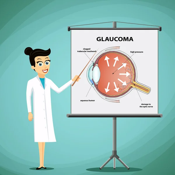 Il dottore mostra su un diagramma a lavagna dell'occhio umano. Glaucoma — Vettoriale Stock