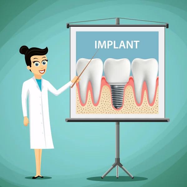 Tandarts weergegeven: poster met tand implantaat — Stockvector