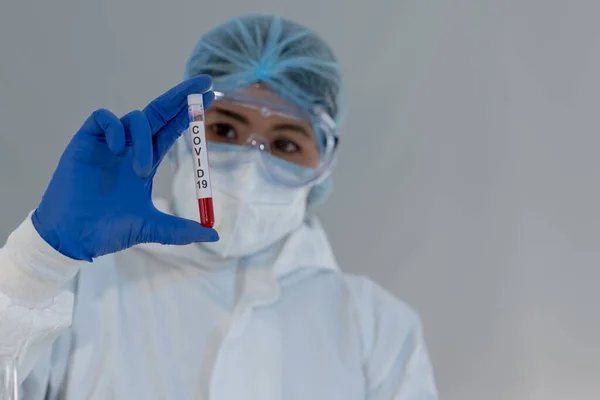 Kan tüpünü kapat. Laboratuvarda Asyalı bir bilim adamı enfekte olmuş bir kan tüpünü tutuyor. Virologlar laboratuvarda koronavirüs salgınını önlemek için antikor aşısını araştırdılar ve icat ettiler.