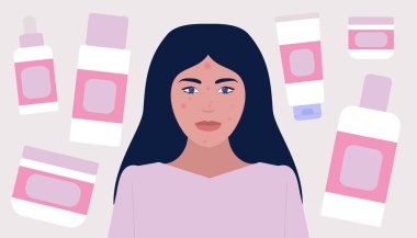 Kozmetoloji, dermatoloji konsepti. Genç kadının cilt sorunları var. Renkli düz vektör illüstrasyonu