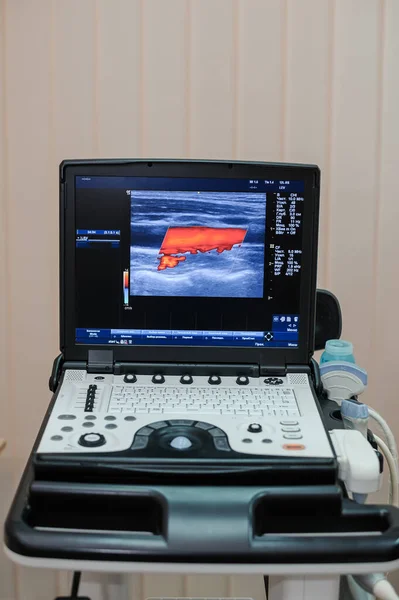 Alt ekstremitelerde ultrason. Klinik