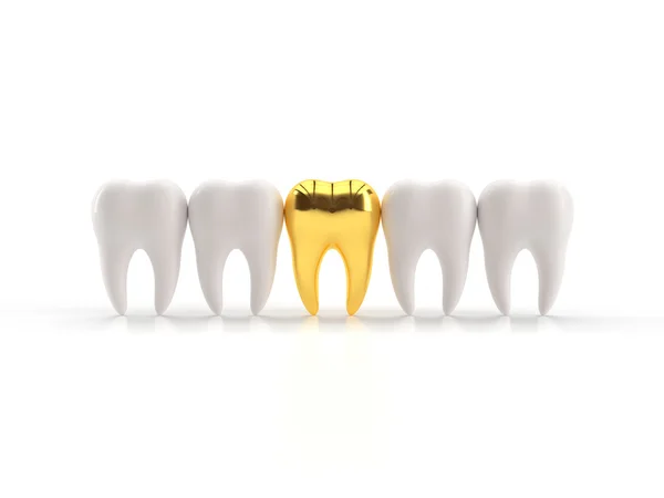 3D złoty ząb — Zdjęcie stockowe