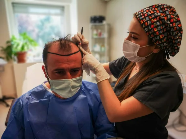 Before Hair Transplantation surgery cute  nurse marking the head with eyeliner