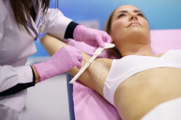 Doctor painting on the armpit of her patient, the area to be treated for hyperhidrosis. — Stock Photo, Image