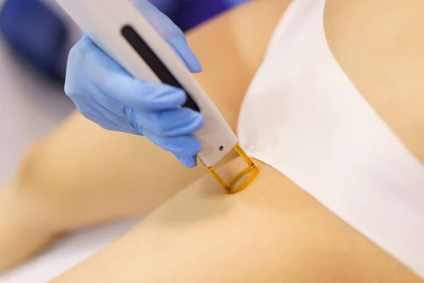 Kvinnan får injektioner laser hårborttagning på ett skönhetscenter. — Stockfoto