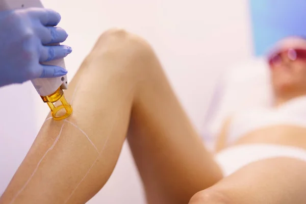 Kvinnan får ben laser hårborttagning på en skönhetscenter. — Stockfoto
