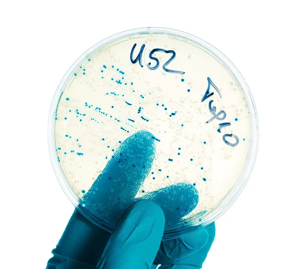 Mano en guante de nitril sostiene placa de Petri con colonias bacterianas — Foto de Stock