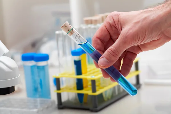 Een reageerbuis met blauwe vloeistof in de hand. Science lab onderzoek — Stockfoto