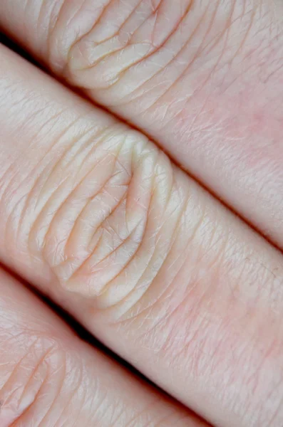 Texture della pelle umana — Foto Stock