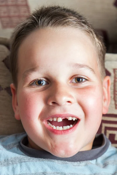 Little boy with a torn front first milk tooth — Stock Photo, Image