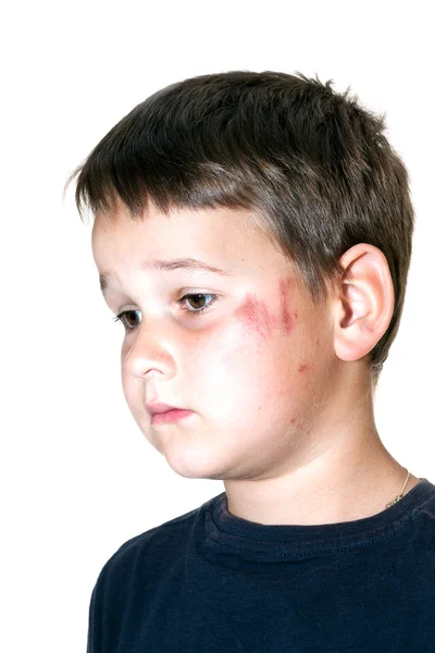 Menino triste com um rosto raspado — Fotografia de Stock