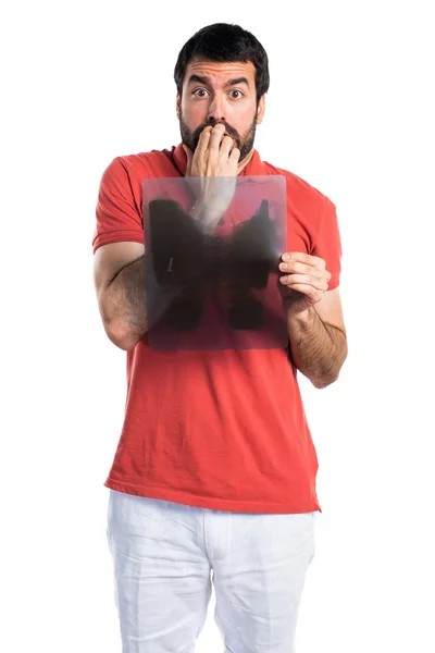 Hombre guapo sosteniendo un escáner óseo —  Fotos de Stock