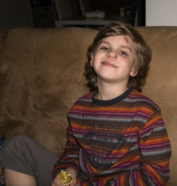 Boy with bruise and scratch on the face — Stock Photo, Image