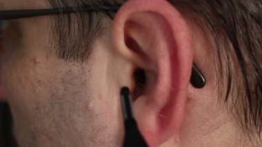 Kulak kıllarını taşınabilir bir elektrikli budayıcı ile buduyor..