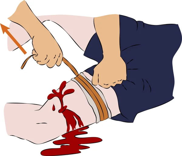 Primeira ajuda - pare o sangue na perna com elástico — Vetor de Stock