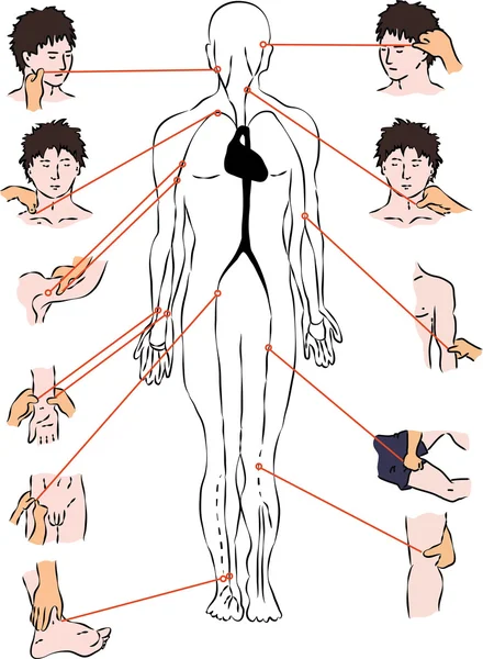 Erste Hilfe - Schema der Arterien — Stockvektor