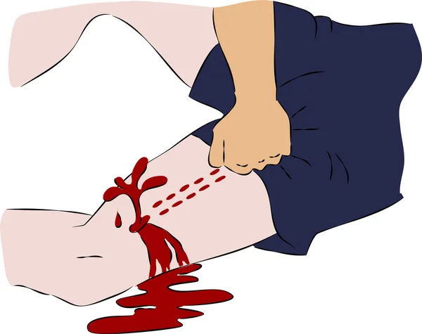 急救-密切血流从腿上的伤口 — 图库矢量图片