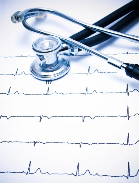 聴診器と心電図のグラフ — ストック写真