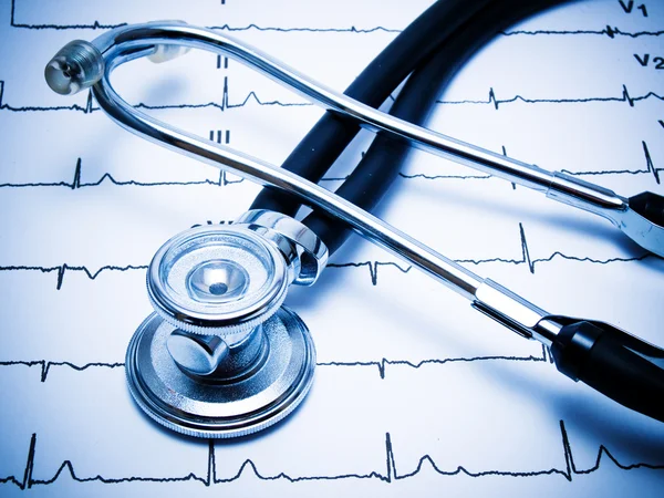 Stéthoscope et graphique ECG — Photo