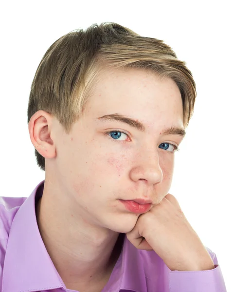 Teenager with acne on his face. — Stock Photo, Image