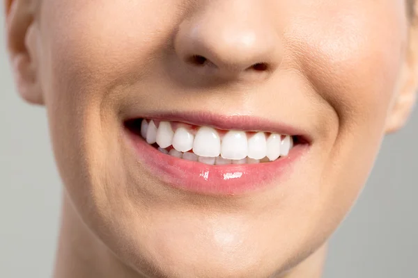 Женщина улыбается, отбеливание зубов, стоматологическая помощь — стоковое фото