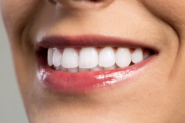 하얀 치아를 보여주는 젊은 여 대 미소의 세부 사항 — 스톡 사진