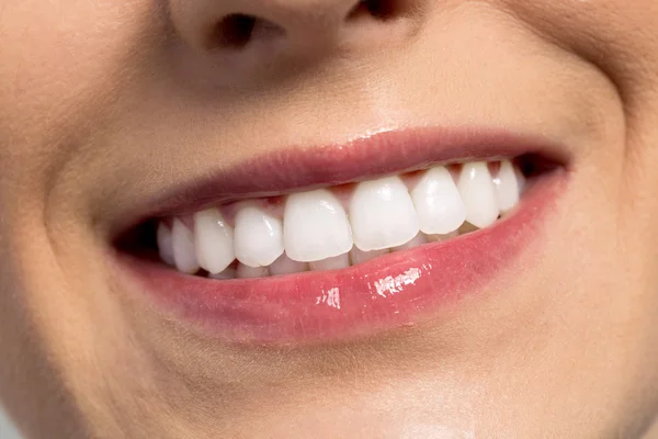 Úspěch šťastný úsměv s dokonalé zuby — Stock fotografie