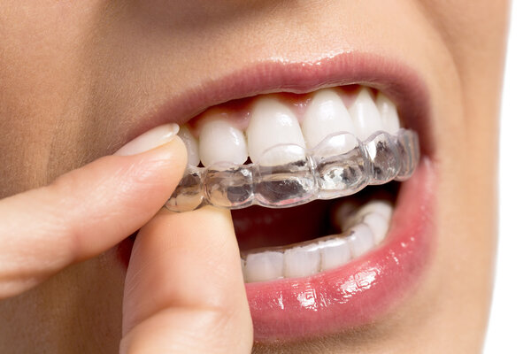 Wearing orthodontic silicone trainer