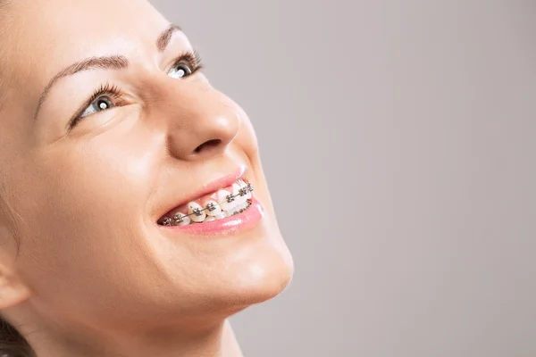 Young beautiful girl with braces on teeth — Stock Photo, Image