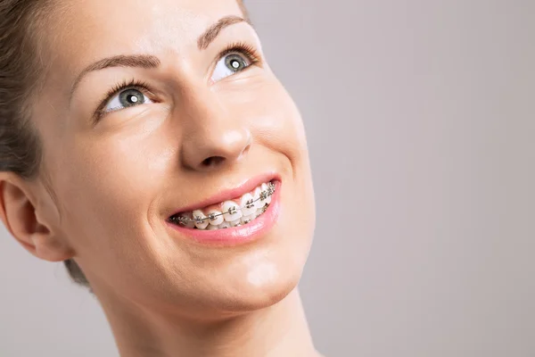 Frenos Dientes Sonrisa femenina — Foto de Stock