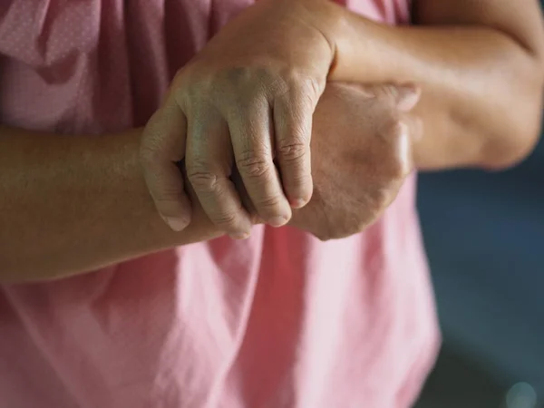 Kvinna Som Håller Händer Sällsynta Sjukdom Kropp Immunsystemet Angriper Nerver Stockfoto