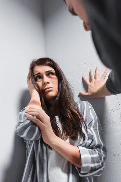 Frightened Woman Bruises Face Hand Head Looking Husband Blurred Foreground — Stock Photo, Image