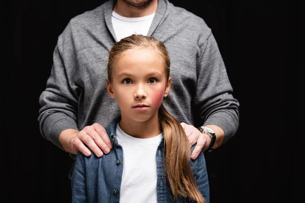 Padre Abrazando Niño Con Moretones Mejilla Aislado Negro — Foto de Stock